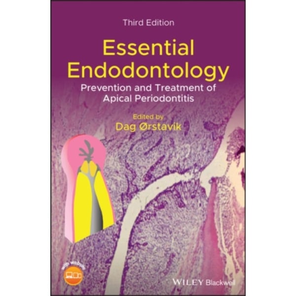 Essential Endodontology (inbunden, eng)