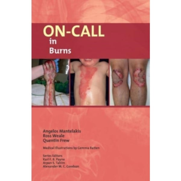 On-Call in Burns (häftad, eng)