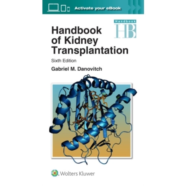 Handbook of Kidney Transplantation (häftad, eng)