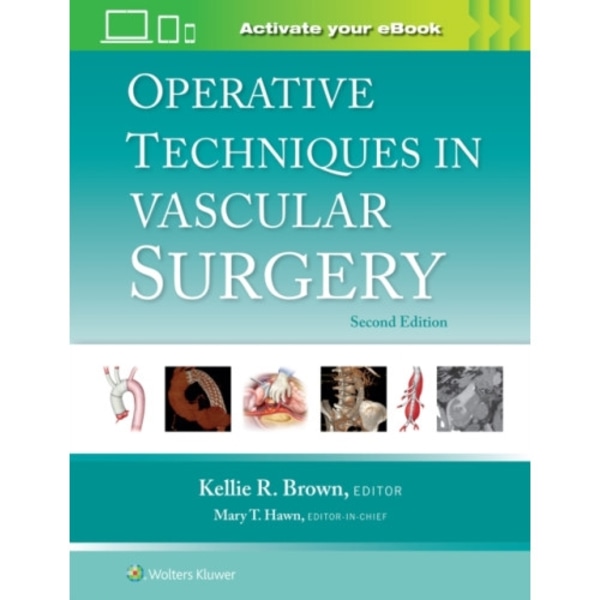 Operative Techniques in Vascular Surgery: Print + eBook with Multimedia (inbunden, eng)