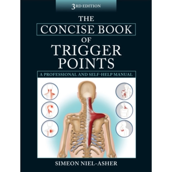 The Concise Book of Trigger Points (häftad, eng)