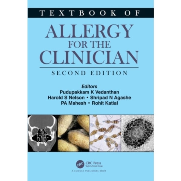 Textbook of Allergy for the Clinician (häftad, eng)