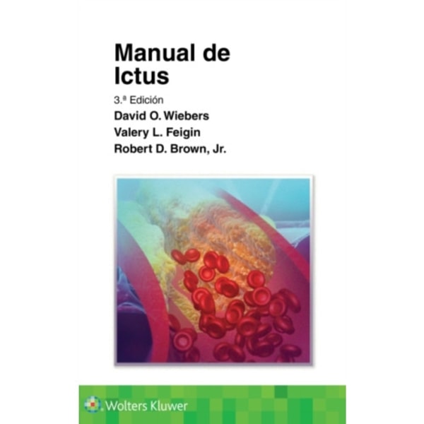 Manual de ictus (häftad, spa)