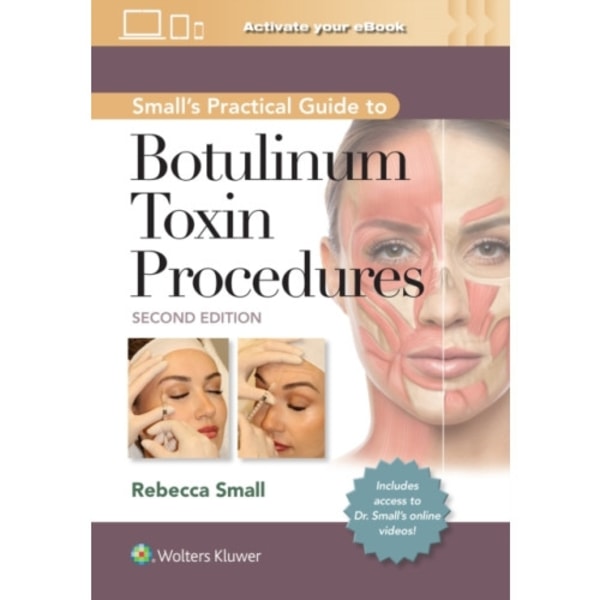 Small's Practical Guide to Botulinum Toxin Procedures: Print + eBook with Multimedia (inbunden, eng)