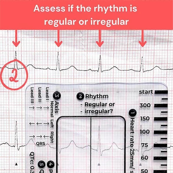 2 st ECG 7-stegs linjal, ECG 7-stegs linjal för ECG/EKG-tolkning, ECG-linjal, portabel ECG-bedömning As Shown