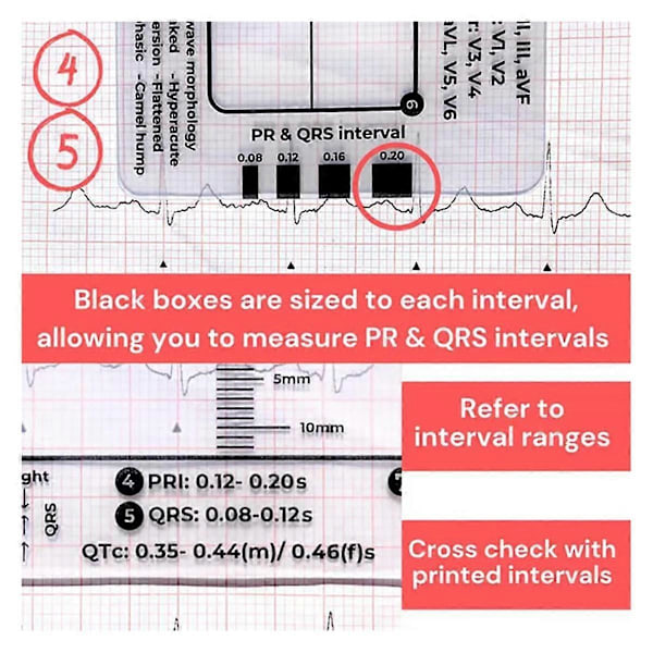 2 st ECG 7-stegs linjal, ECG 7-stegs linjal för ECG/EKG-tolkning, ECG-linjal, portabel ECG-bedömning As Shown
