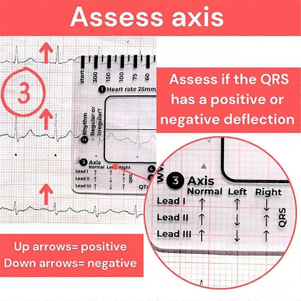 2 st ECG 7-stegs linjal, ECG 7-stegs linjal för ECG/EKG-tolkning, ECG-linjal, portabel ECG-bedömning As Shown