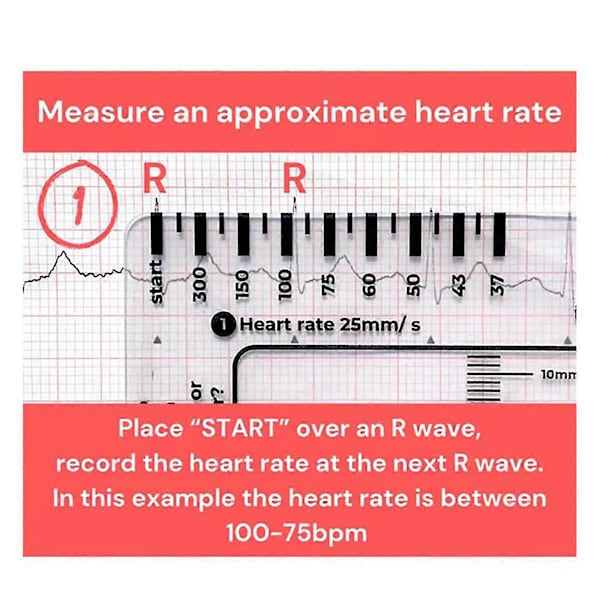 2 st ECG 7-stegs linjal, ECG 7-stegs linjal för ECG/EKG-tolkning, ECG-linjal, portabel ECG-bedömning As Shown