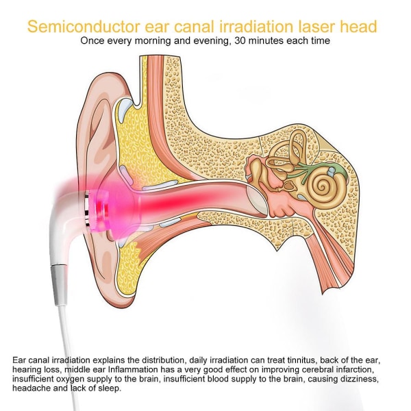 Tinnitus Öronlaserterapi LLLT Bestrålning Laser Fysioterapi Öronpropp Otitis