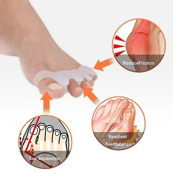 2 kpl Hallux Valgus varvaserotin erottaa varpaat varvasen tuki varvaserotin