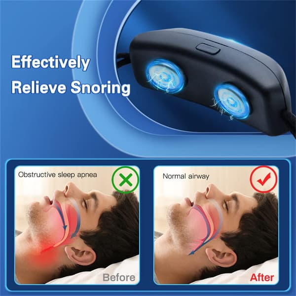 Smart Anti-snorkeenhet Sekunder Stopp Snorking, Sovende ansikt