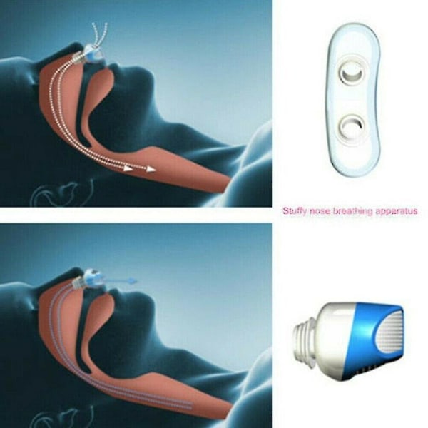 Micro Cpap Anti Snoring Elektronisk enhet för sömnapné Stoppa Snarkhjälp Stopper Hjälpmedel Stoppare Luftrenare Filter red