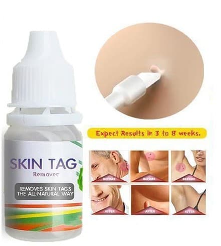 Lazada Fodpleje Ligtorn Reparationsopløsning