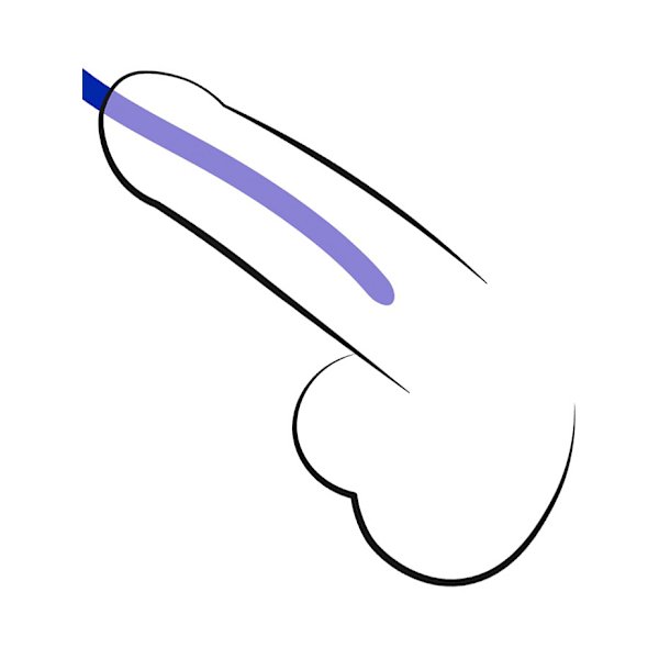 You2Toys: Silicone Urethra Dilator Set, 3-pack Blå