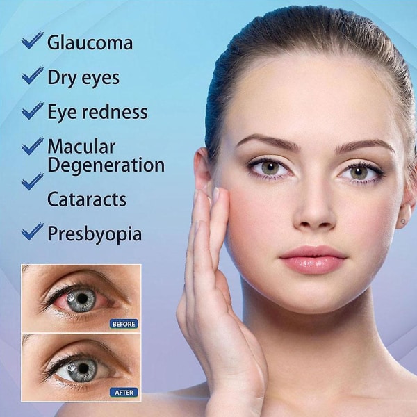 Japanese Eye Care Liquid Brightening Solution, Lindra Eye Fatigue 10ml