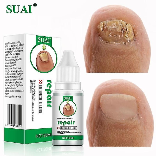 Suai-traitment Antifungal för naglar och fötter, essens, gel, anti-betection, 20ml null none