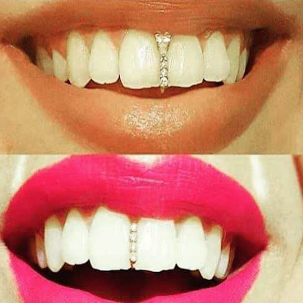 Hip Hop Teeth Grillz Dental Caps Single Clips Grillz 2-GOLD - korkea laatu
