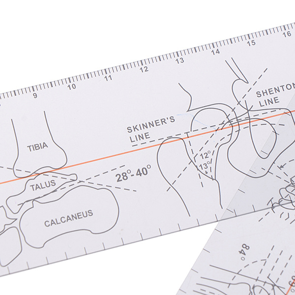 Moniviivainen Goniometer Protractor Ortopedian työkalu - varastossa 1pc