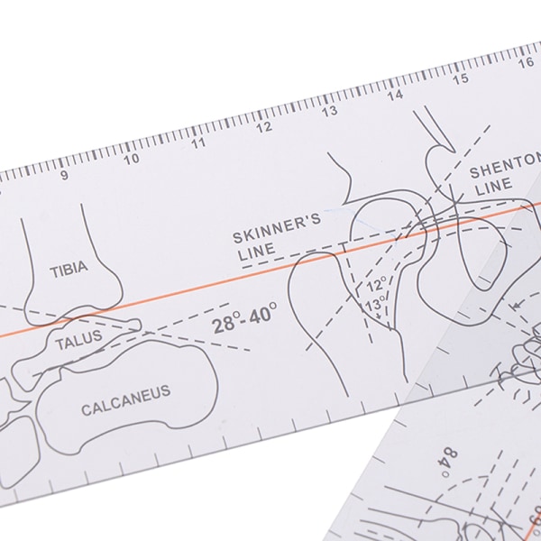 Multi-linjal Goniometer Vinkellinjal Ortopedi verktygsinstrument - on stock 1pc