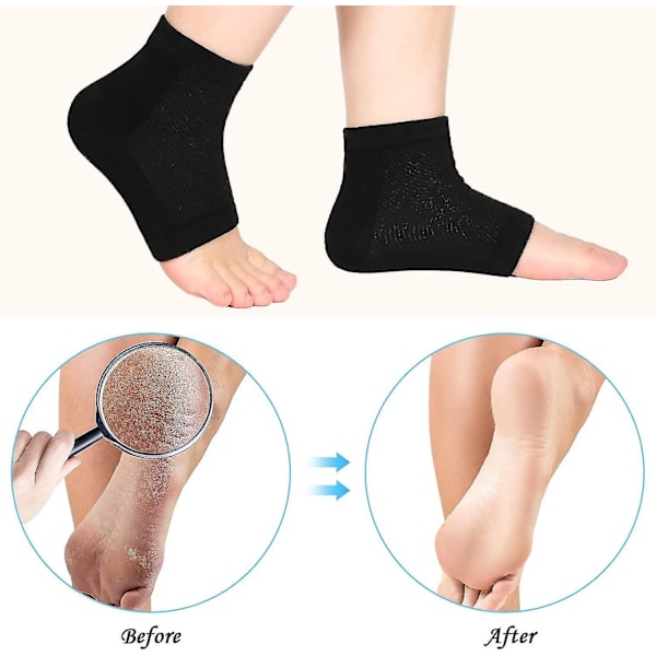 Soft Gel hälstrumpa Andas strumpor med öppen tå 4 par (svarta) - spot sales