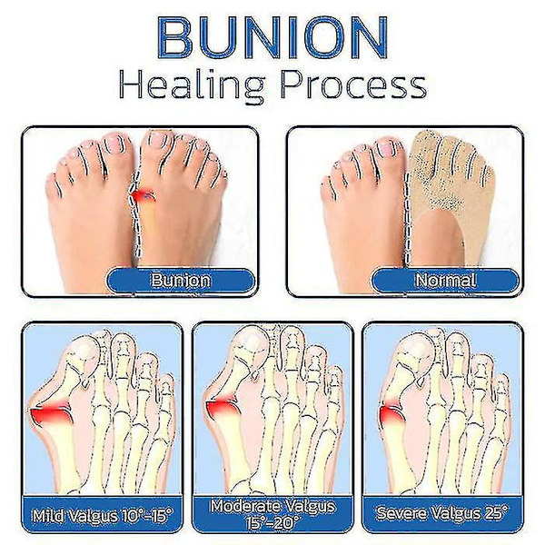 Projoint Anti Bunions Sundhedssokker 2/4/8/10 Par 4 pairs