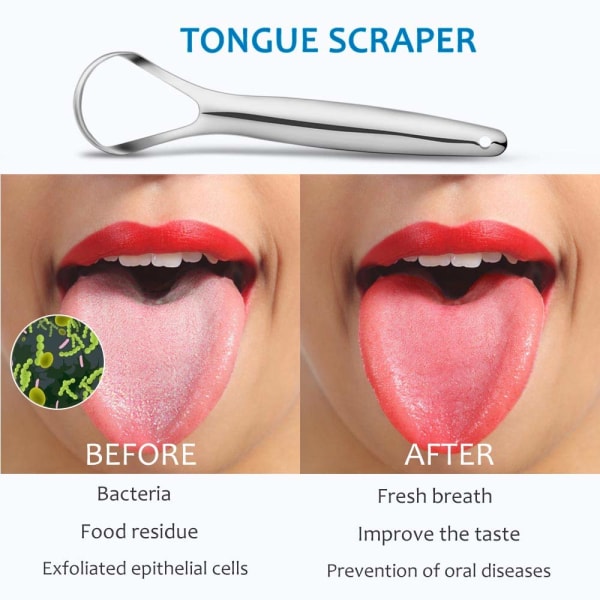 2-pack tungeskraper, 100 % praktisk medisinsk tungerens i rustfritt stål, egnet for voksne og barn, profesjonell reduserer dårlig ånde metalltonn