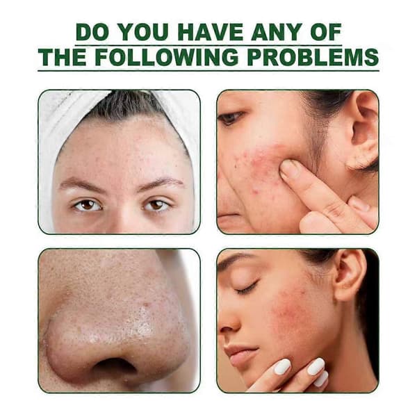 1-3x Grøn Te Maske Solid Rensemaske Mudder Maske Til Mænd Og Kvinder Fjernelse Af Hudorme 2pcs