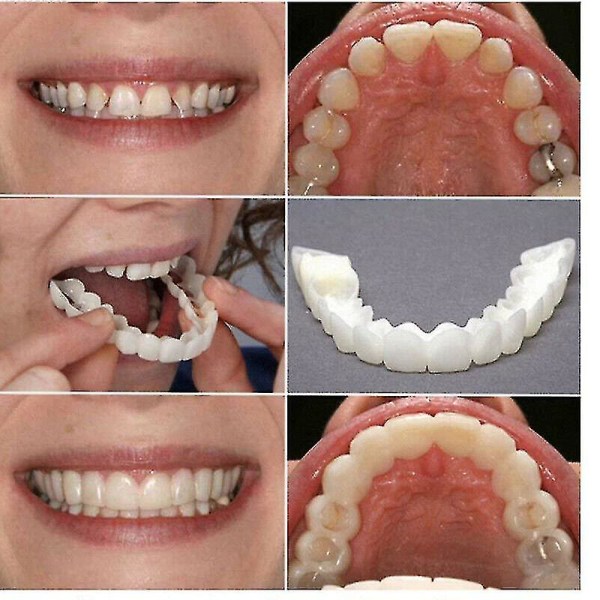 Snap On falske tenner Øvre + Nedre Dental Finer Proteser Tanndekselsett A Upper Lower teeth