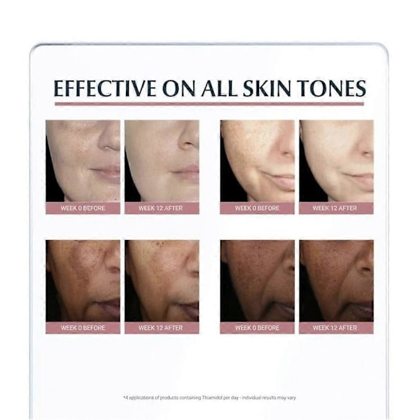 Eucerin Anti Pigment Spot Corrector 5ml