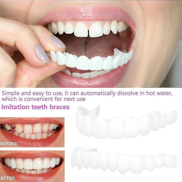 Smile Dental cover Perfect Smile Veneers Comfort Fit Flex hammasproteesihampaat