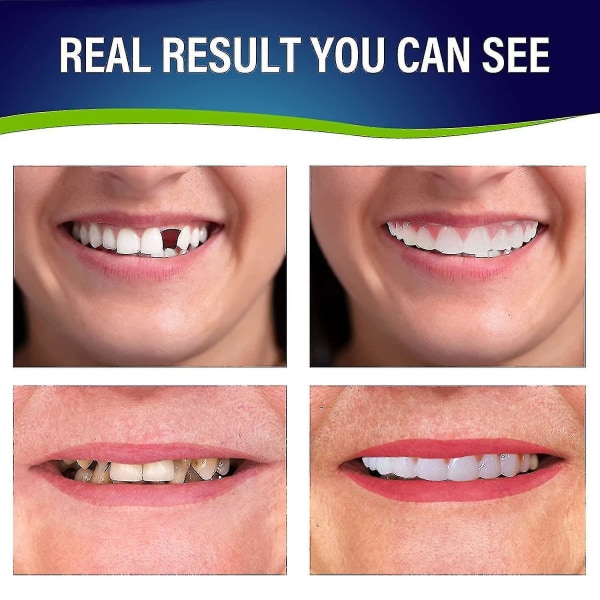 2 sæt tandproteser, øvre og nedre tandproteser, naturlige og komfortable,  beskytter tænder og genvinder selvtillid og smil b584 | Fyndiq