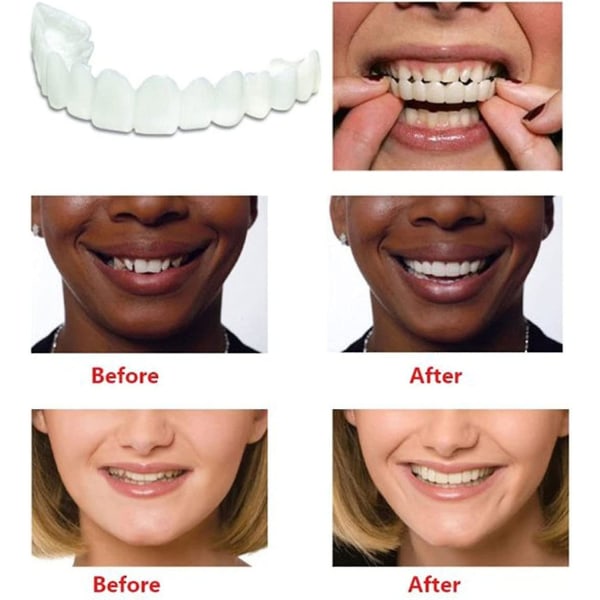 Snap On Teeth Faner, perfekta tänder tillfälligt ersättning Fa
