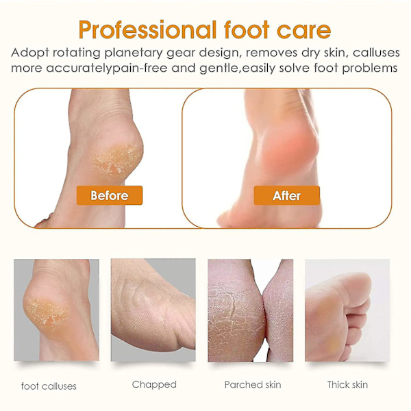 Genopladelig elektrisk fodrasp, elektrisk pedicure fodslibemaskine