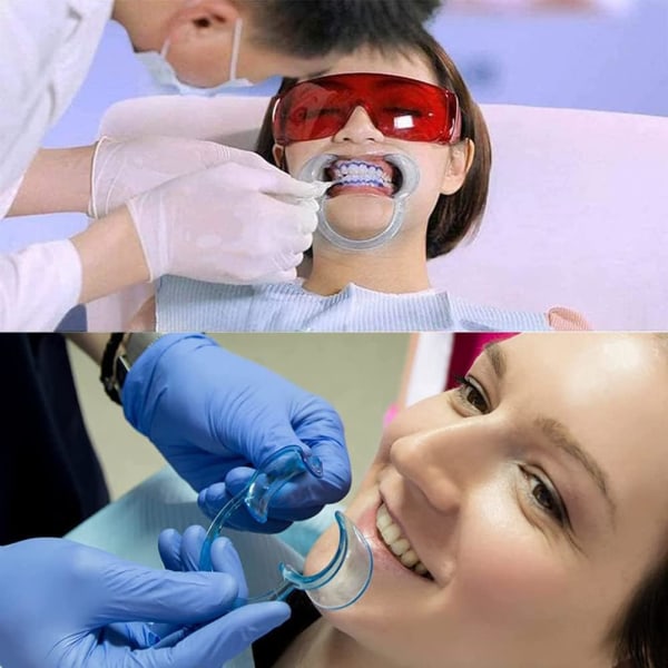 Dental Retractor Retractor, 4st C-Shape Öppnare, Mun Retractor, De