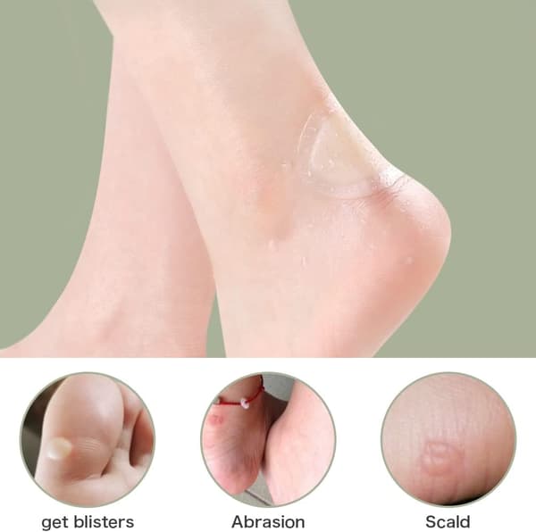 15-pakning blemmeplaster, 5 stiler usynlige vanngel blemmeplaster