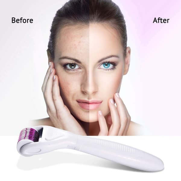 6-i-1 Derma Roller Kit til ansigt og krop - 0,25 mm og 0,3 mm mikronål