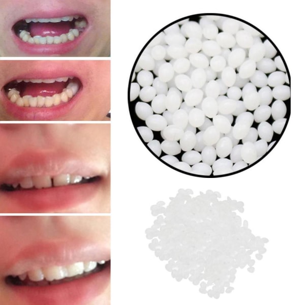 Tillfälligt tandersättningsmaterial - 12 gram, 20ml, Reparations t