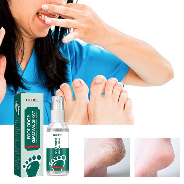 Luktborttagare Fot- och skospray Förhindra illaluktande deodorant Reduce S greenA 30ml 5pcs