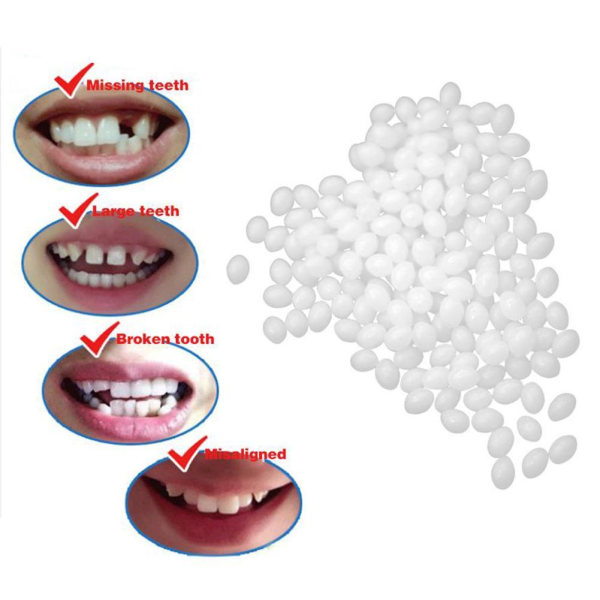 Tillfälligt tandersättningsmaterial - 12 gram, 20ml, Reparations t