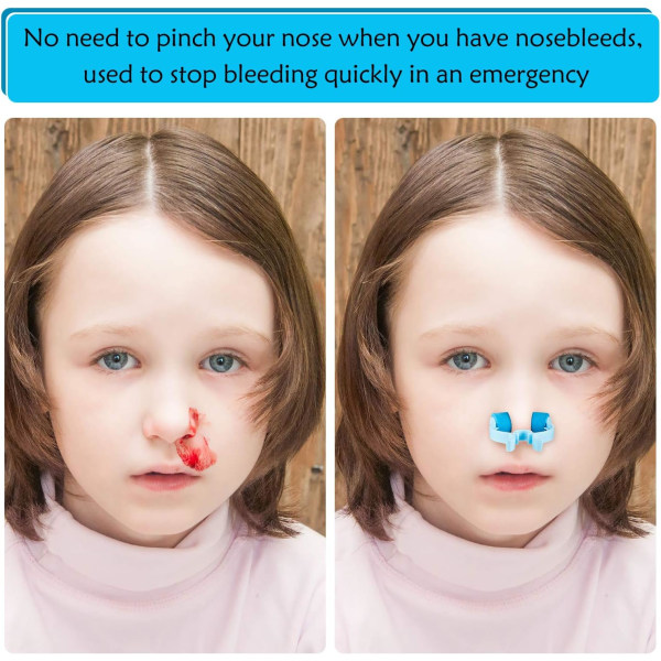 Nosstoppklämmor Nasal Nosproppklämmor Plastskum näsklämmor för nödsituationer eller olycka