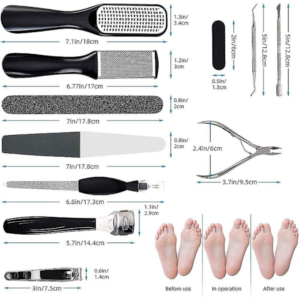 Pedikyrset 15 i 1, Fotfil Callus Remover Hård, Sprickig, Död Hud Fotvård Verktyg - Professionellt Pedikyrverktygssats För Män, Kvinnor