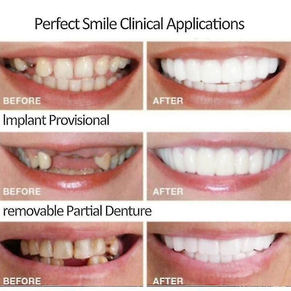 2 st Snap On Smile Övre Falska Tänder Tand Veneers Protes Set