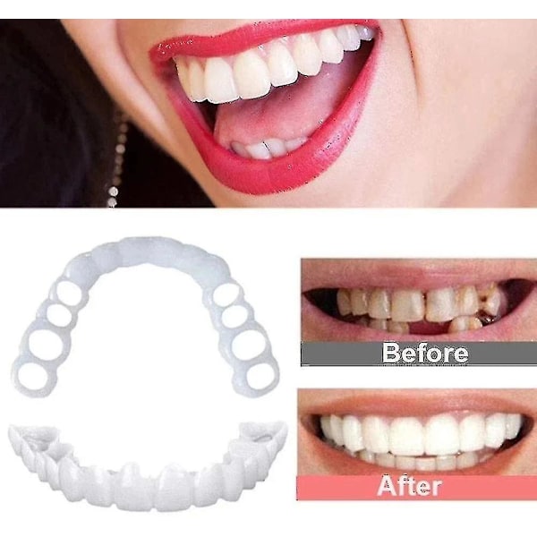 2 st Snap On Smile Övre Falska Tänder Tand Veneers Protes Set