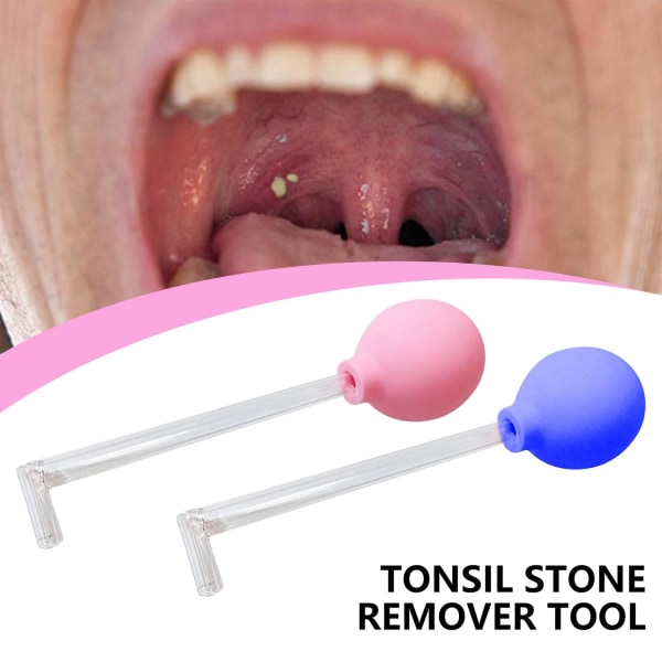 Mundpleje Mandler Stenfjernelsesværktøj Manuel Style Renser Fjernelse Mundrensning Oral Care Mundrens til voksne 1 stk. 1