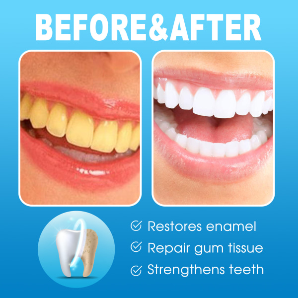 Tandreparationsgel för djuprengöring av tänder, fläckar, plack och tandsten - tandköttsvård och munhygien