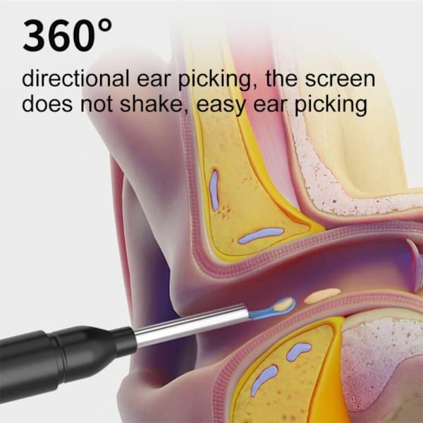 Smart Ear Cleaner with Camera - Wireless & Safe Ear Inspection Black black