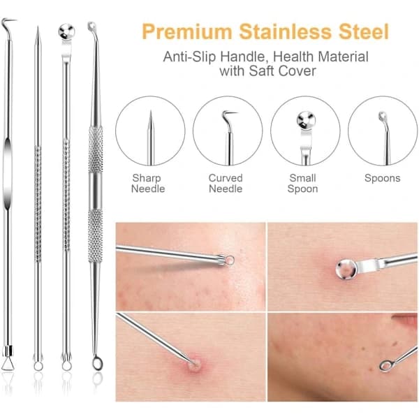 Blackhead Remover Kit med 10 dele i rustfrit stål