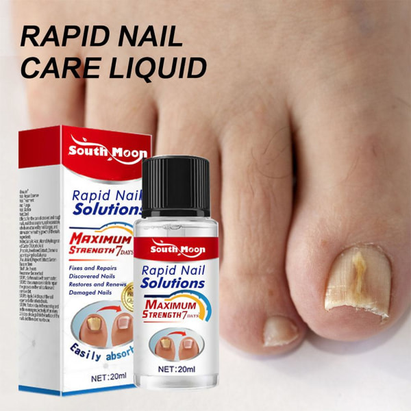 Onychomycosis Antibakteriell lösning 7 Days Strengthening Rapid whiteA 20ml