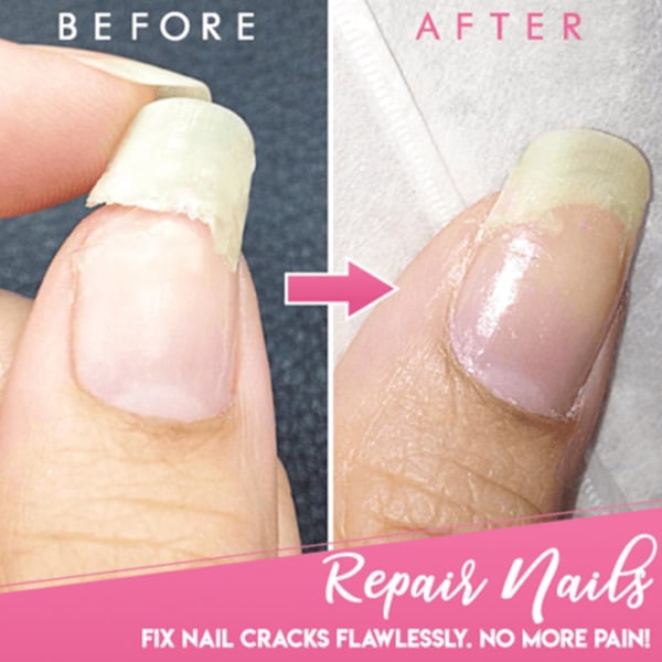Gellack för nagelreparation - Cracked Nail Repair Gel Armor