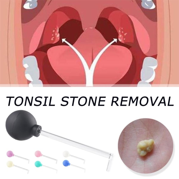 XinYuan Tonsil Stone Remove Tool, 2023 New Manual Style Cleaner R black 1pcs